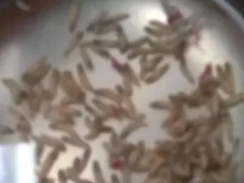 Đau mũi đi khám, bác sĩ sốc nặng khi lấy ra thứ trong mũi người phụ nữ