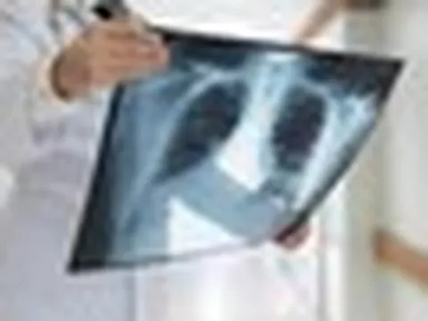 Chụp chiếu khắp nơi không ra bệnh, nam thanh niên 27 tuổi nhập viện tâm thần vì lý do bất ngờ